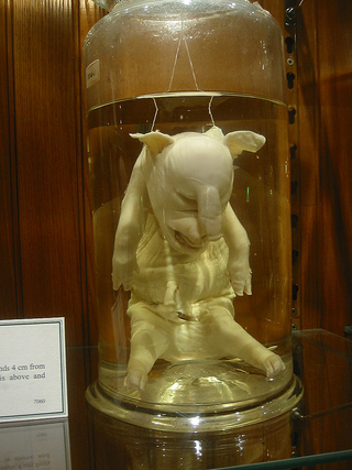 Illustration for article titled Museum of WTF: Mutant Pickled Babies and the World's Largest Colon